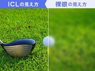 ICLの見え方、裸眼の見え方