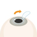 STEP3 フラップ翻転