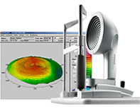 角膜形状解析装置Varioトポライザー 機器の画像