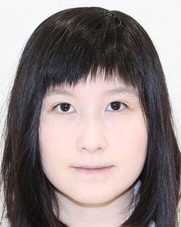Icl 眼内コンタクトレンズ 症例 女性 26歳 自営業 レーシックの 新宿近視クリニック Icl 眼内コンタクトレンズ 症例 女性 26歳 自営業 レーシックの 新宿近視クリニック