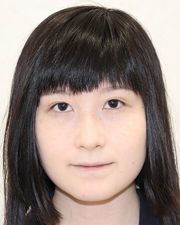 Icl 眼内コンタクトレンズ 症例 女性 26歳 自営業 レーシックの 新宿近視クリニック Icl 眼内コンタクトレンズ 症例 女性 26歳 自営業 レーシックの 新宿近視クリニック