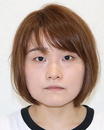 Icl 眼内コンタクトレンズ 症例 女性 27歳 会社員 レーシックの 新宿近視クリニック