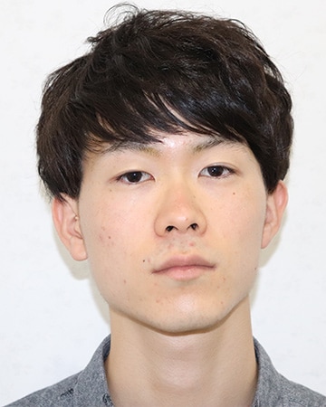 Icl 眼内コンタクトレンズ 症例 男性 25歳 会社員 レーシックの 新宿近視クリニック