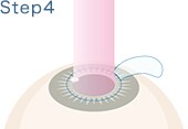 STEP.4