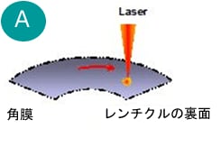 レンチクルの作成シェーマ_A