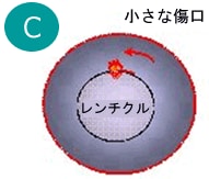 レンチクルの作成シェーマ_C