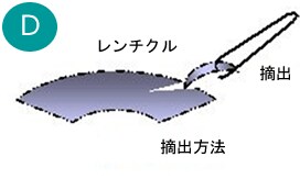 レンチクルの作成シェーマ_D