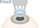 STEP.2