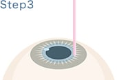 STEP.3