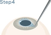 STEP.4