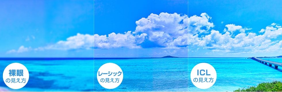 裸眼、レーシック、ICLの見え方の比較