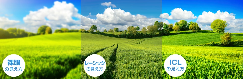 裸眼、レーシック、ICLの見え方の比較